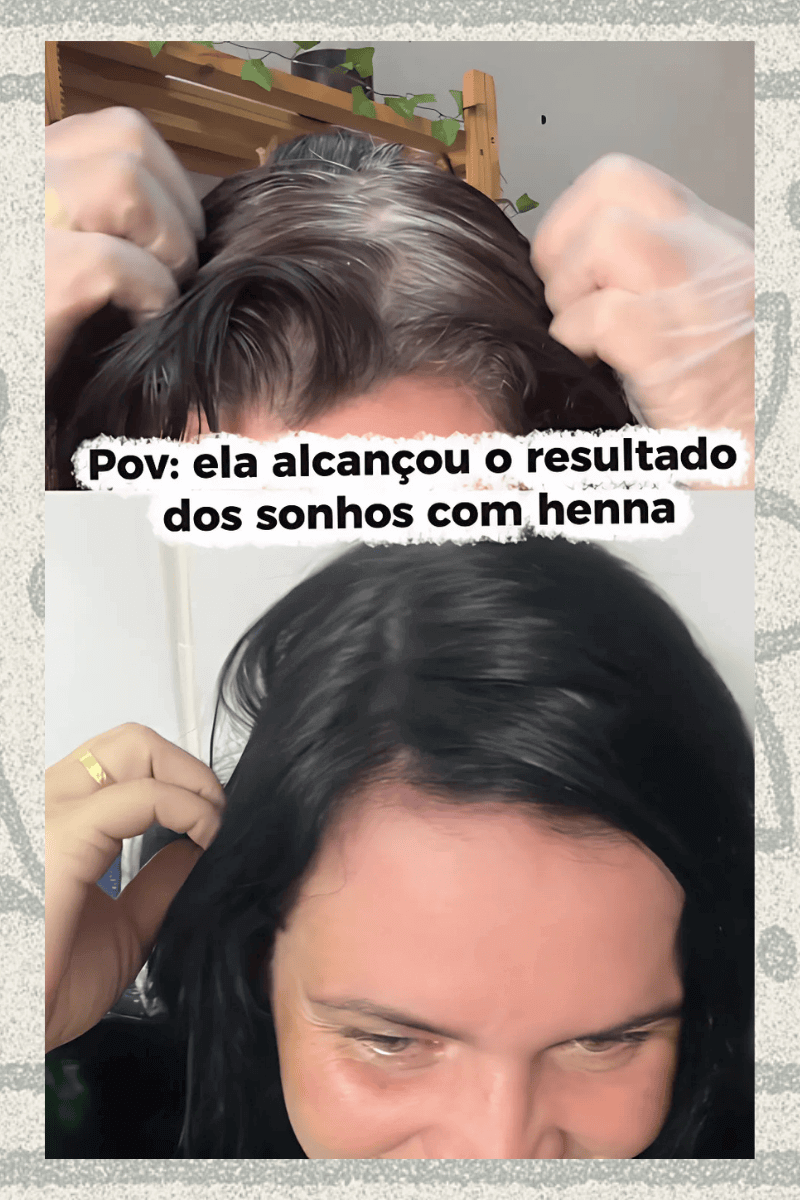 Antes e depois da Mari — Método Adeus Brancos